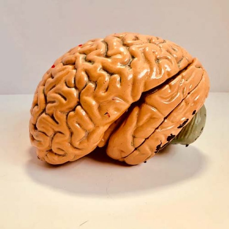 Significado de Cerebro